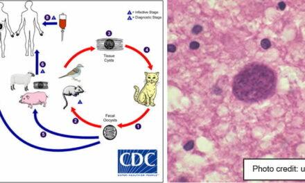 Toxoplasma Gondii: In Politik und Staatsführung eine enorme Gefahr